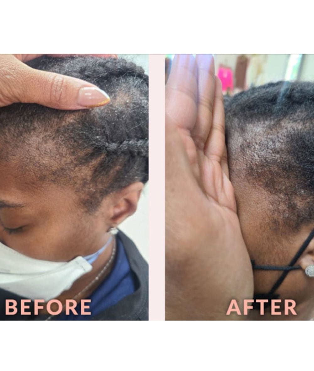 Design Essentials Scalp Care Edge & Temple Strengthening Oil 4oz, HAIR CARE - Cloré Beauty