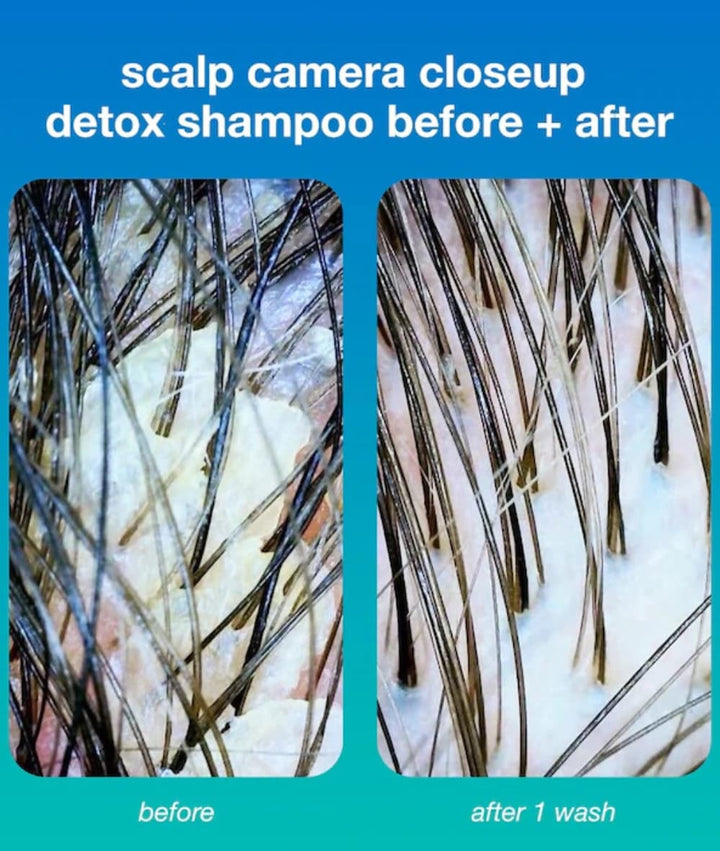 K18 Peptide Prep Detox Shampoo 31.5oz